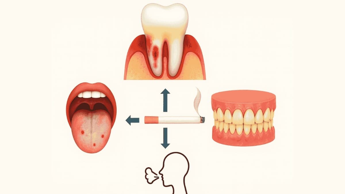 π’ Smokingβs silent toll on teeth