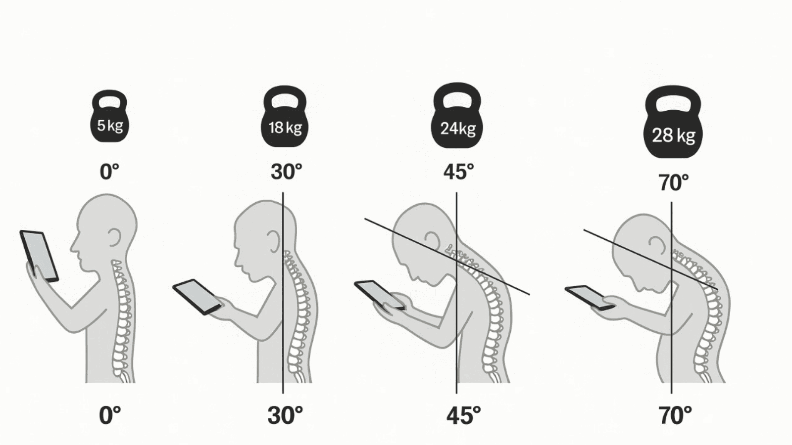 π’ Is tech hurting your neck?